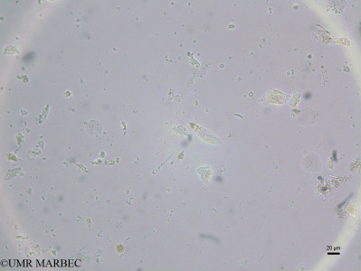 phyto/Brazilian_Nordeste/FernandodeNoronha_station40/ABRACOS2 April 2017/Pronoctiluca rostrata (st44_inf_flagelido2170921_002_ovl)(copy)_thumb.jpg